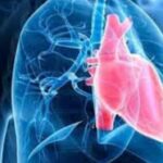 Hipertension Pulmonar
