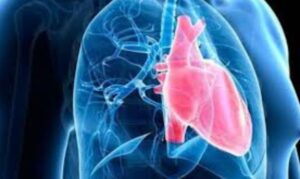 Hipertension Pulmonar